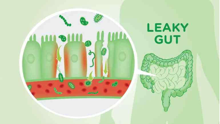 4 Common Mistakes that Cause a Leaky Gut and How to Fix it.