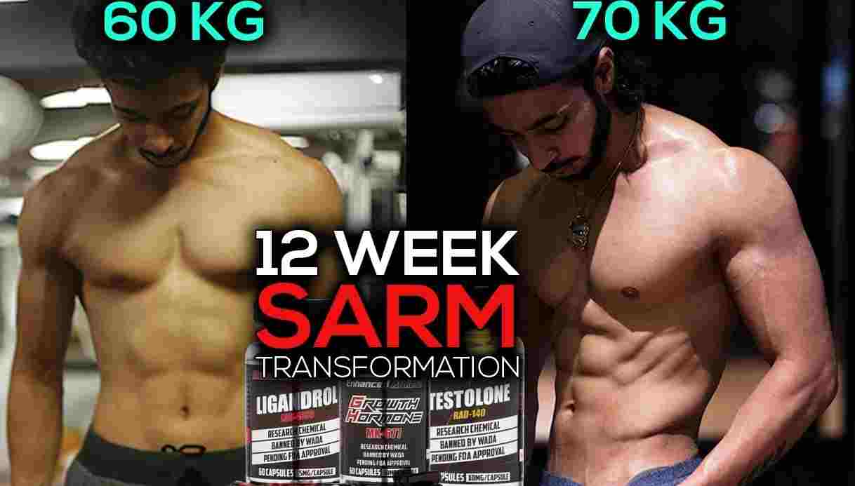 How Selective Androgen Receptor Modulators (SARMs) are Changing the Game